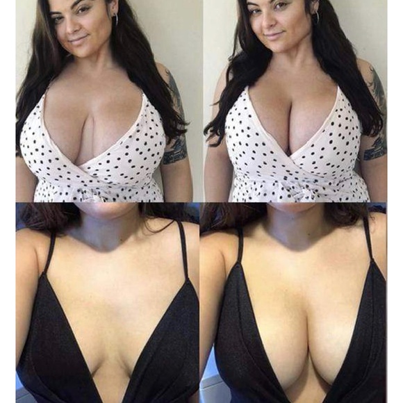 Shapewind Invisible Bra Kit - Picture 2 of 2